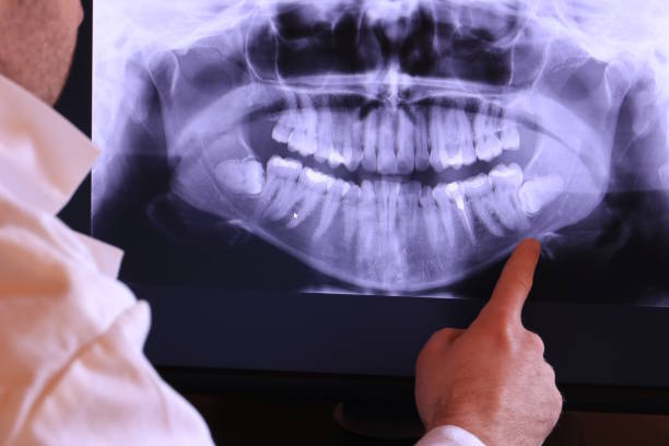 Best Emergency Root Canal Treatment in Garyville, LA